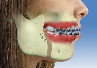 https://www.sbdhost.com/ortho-module/terms/terms-surgery.jpg